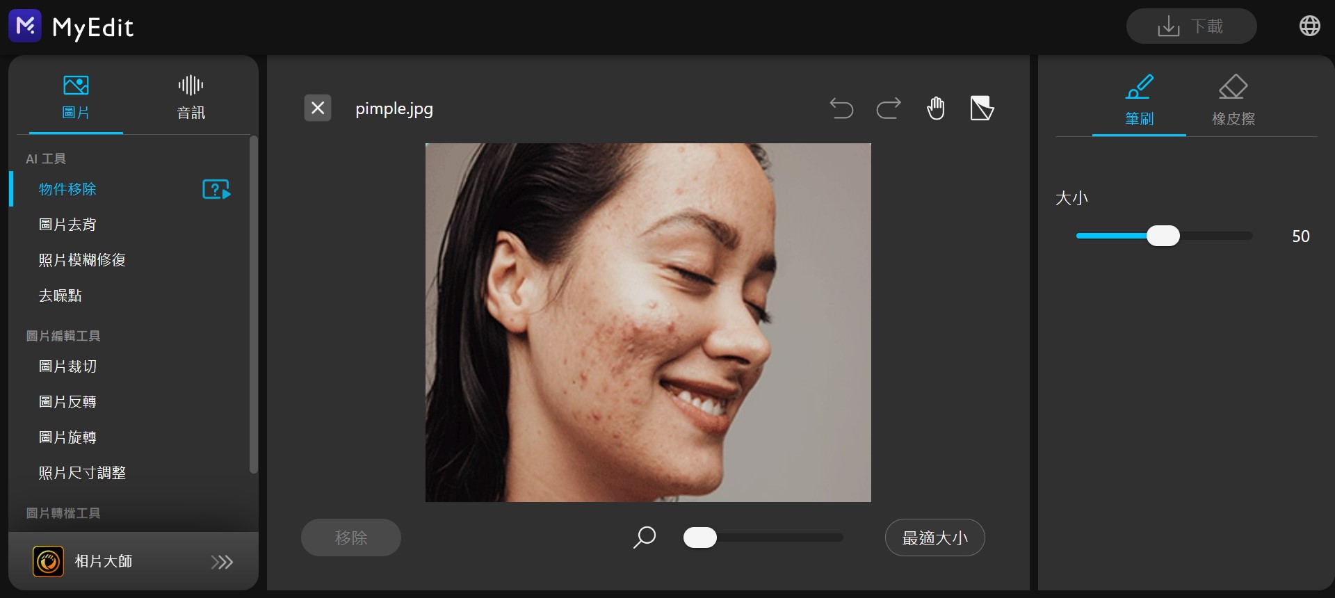 MyEdit 線上修圖去痘痘 介面